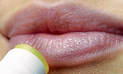 Dark Lips: ಧೂಮಪಾನದಿಂದ ಕಪ್ಪಾದ ತುಟಿಗಳನ್ನು ಮರಳಿ ಕೆಂಪಾಗಿಸುವುದು ಇಷ್ಟು ಸರಳ!