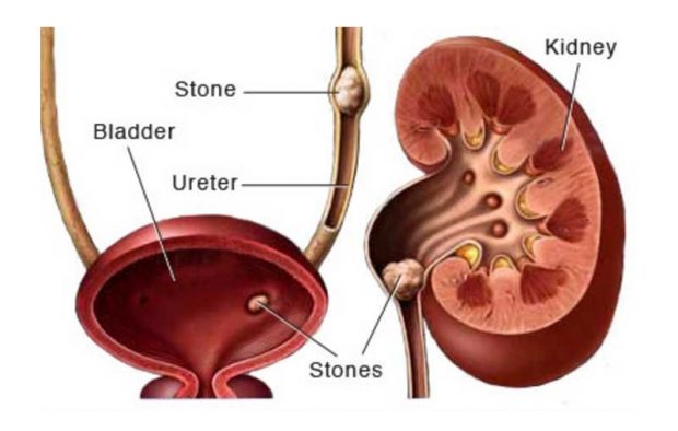 Kidney.jpg