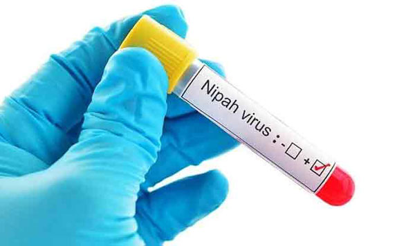 nipah-virus.jpg