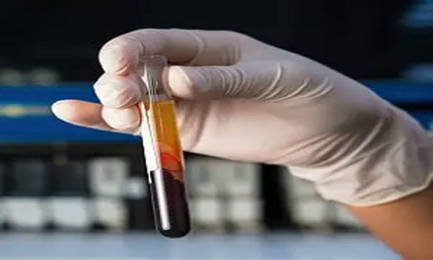 Does blood plasma work on virus patients? experts disagree