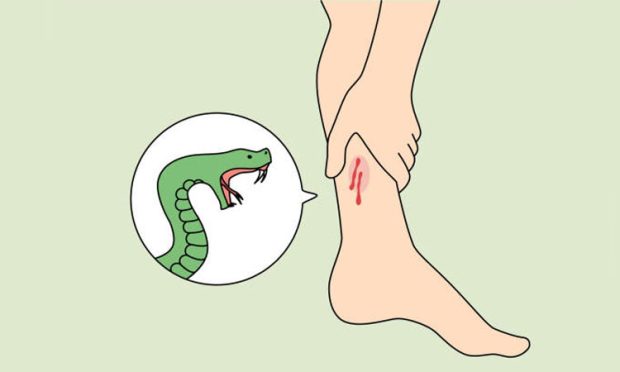 2-snake-bite